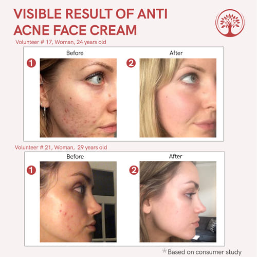 Ivory Natural - Before After