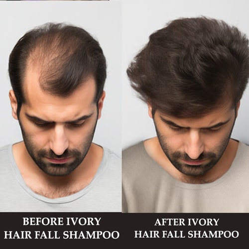 before and after use of Anti Hair Fall Shampoo Organic