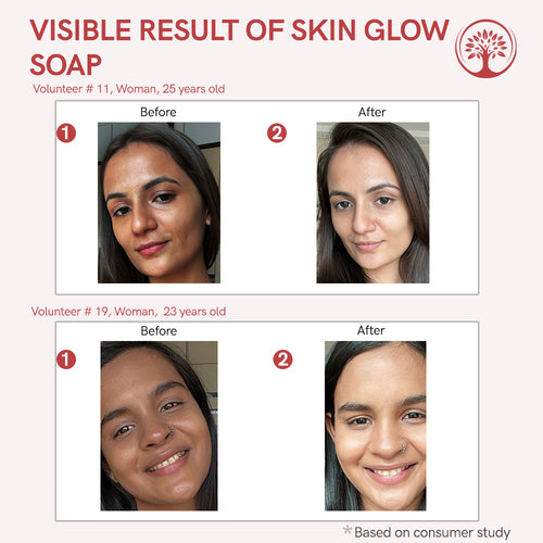 Ivory Natural Skin Glow Soap Before & After