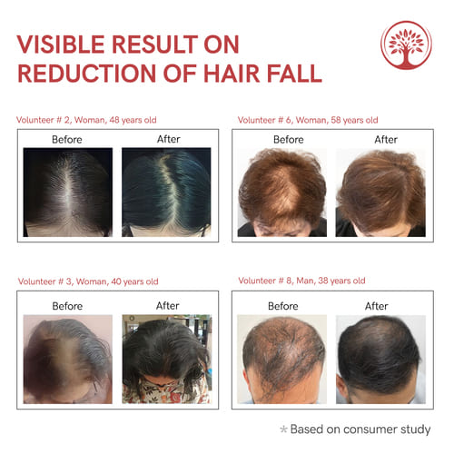 Teacurry Hair Fall Serum Before & After