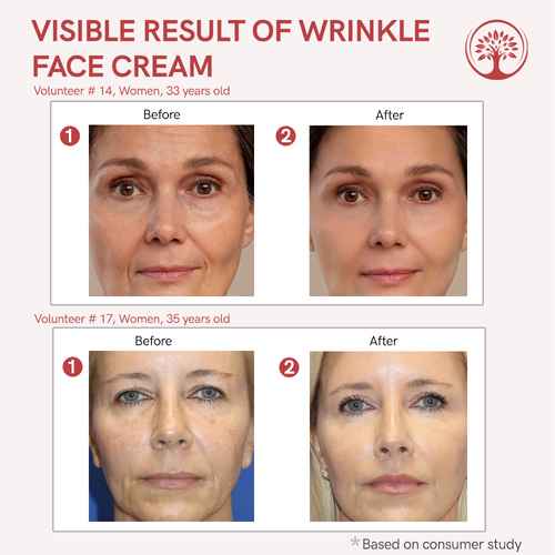 Ivory Natural - Before After