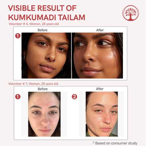 Ivory Natural Kumkumadi Tailam Before and After