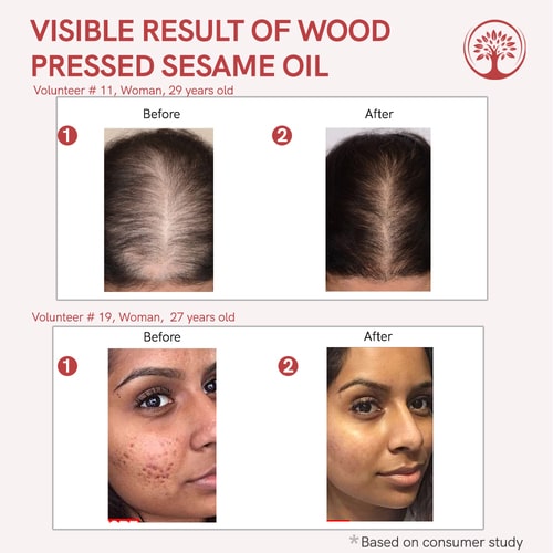 Ivory Natural Organic Sesame Oil Before and After