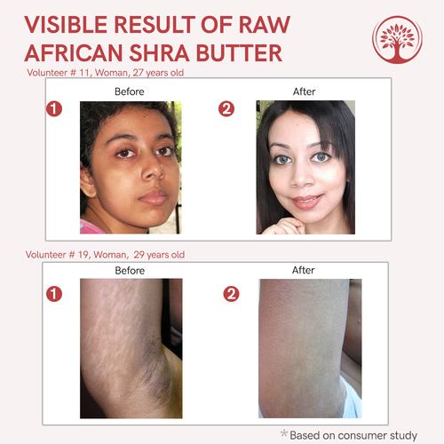 Ivory Natural -Before After