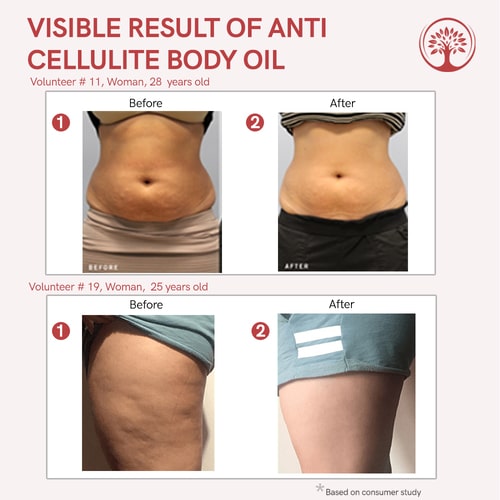 anti cellulite massage oil before and after