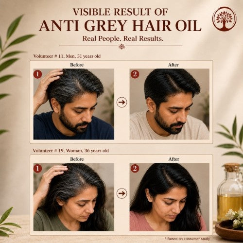Ivory Natural Anti Hair Oil Before After Testimonial 
