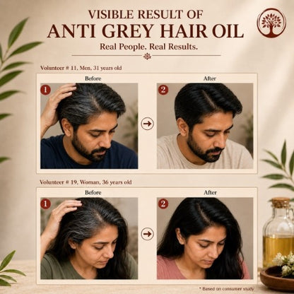 Ivory Natural Anti Hair Oil Before After Testimonial 