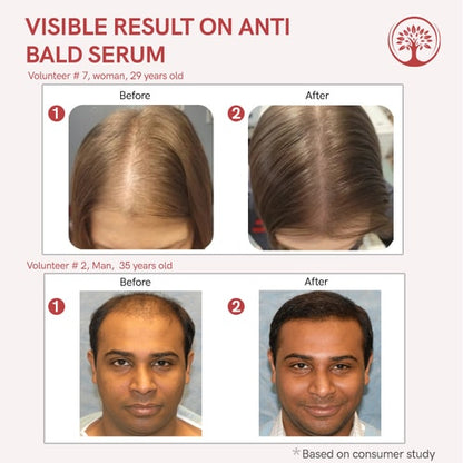 before and after use of Ivory natural Anti bald Serum