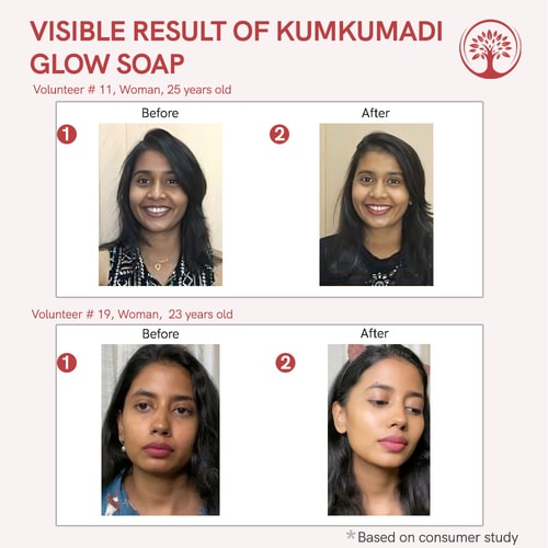 results of dr recommend of Kumkumadi Glow Soap