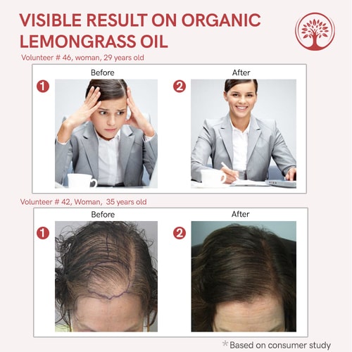Visible result of lemongrass essential oil