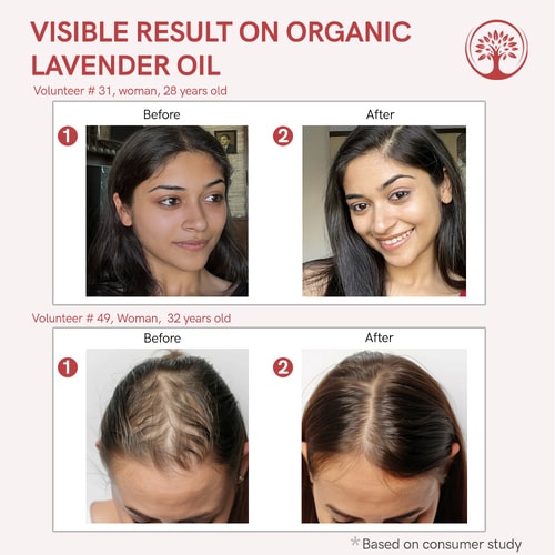 Visible result of lavender essential oil