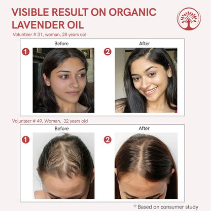 Visible result of lavender essential oil