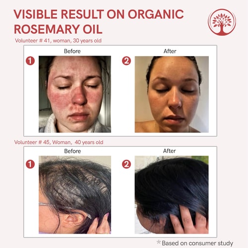 visible result of rosemary essential oil