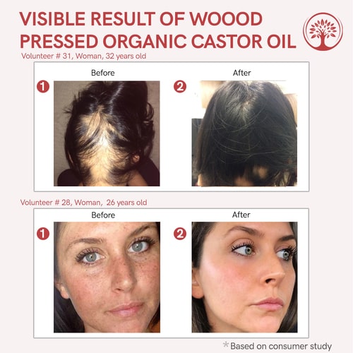 visible result of castor oil cold pressed