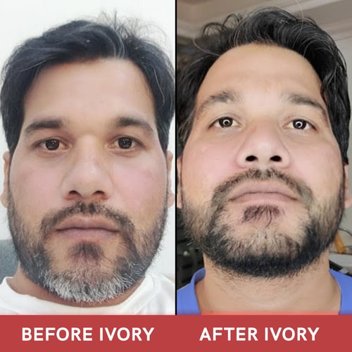Ivory Natural  - Customer Results