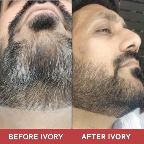 Before and after use of Grey Beard Oil Serum