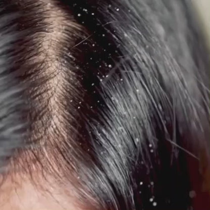 Video of Ivory Natural Anti Dandruff Hair Mist