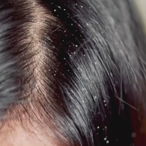 Video of Ivory Natural Anti Dandruff Hair Mist